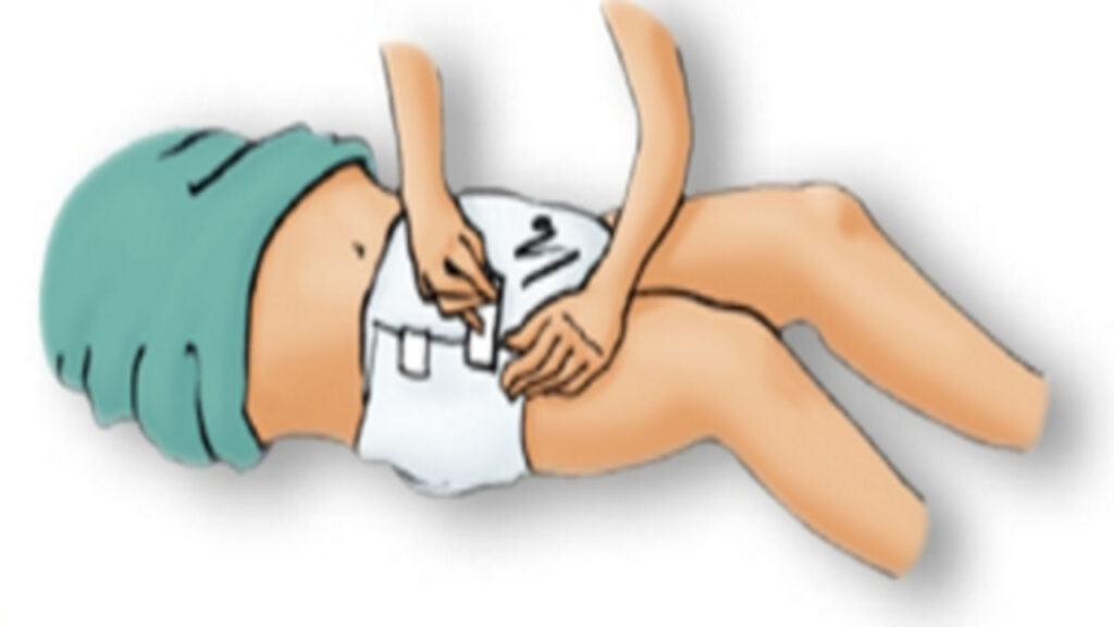 Importance Of Following Proper Guidelines For Changing The Diaper Of A Bedridden Person