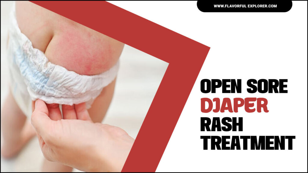 Open Sore Diaper Rash Treatment