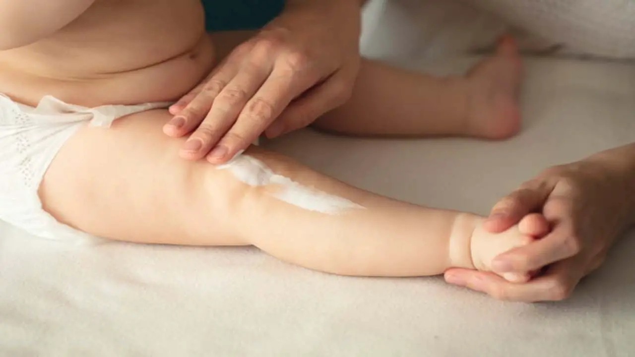 5 Ways To Diaper Fungal Rash Treatment For All Skin Types