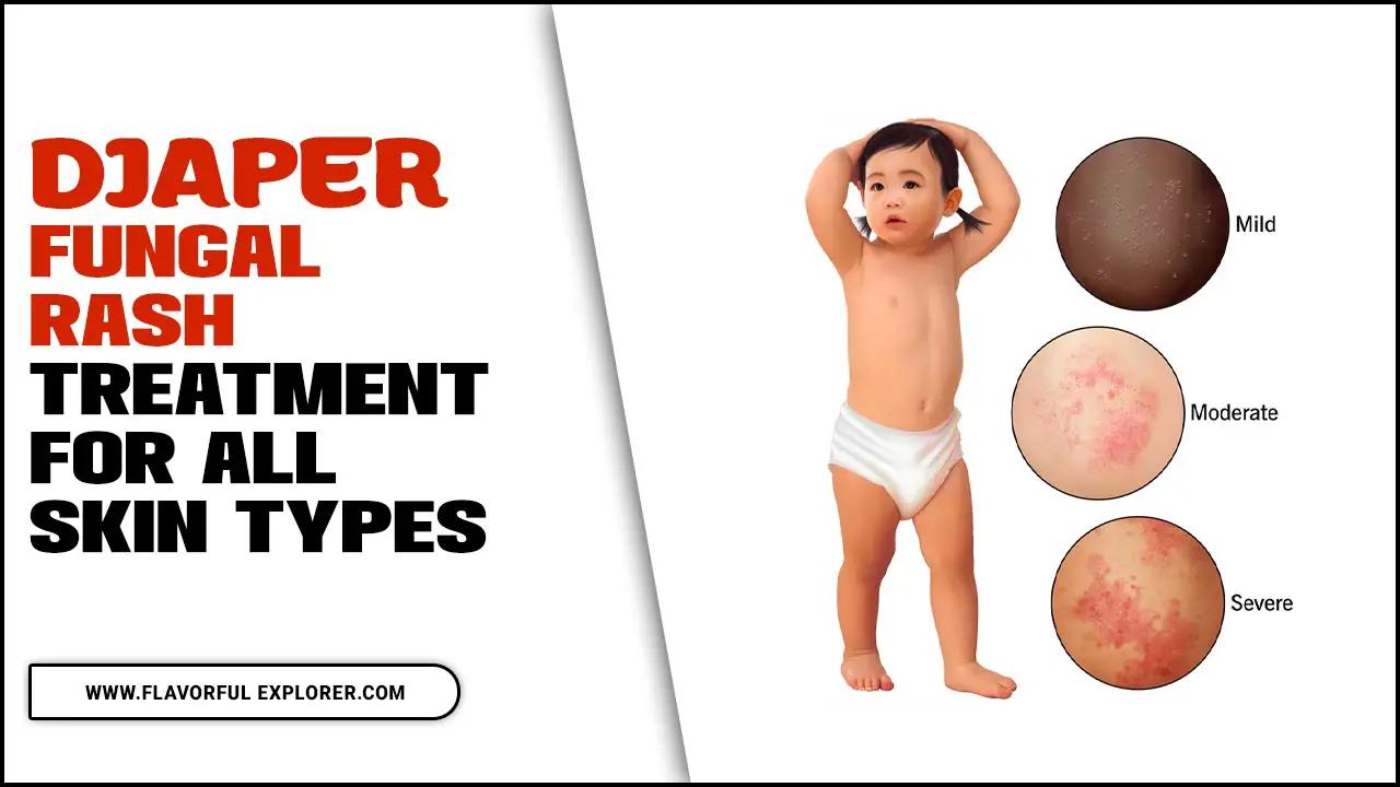 Diaper Fungal Rash Treatment For All Skin Types