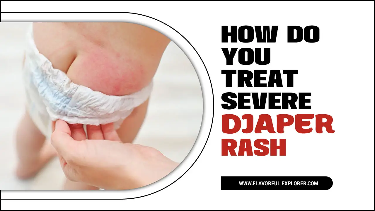 How Do You Treat Severe Diaper Rash