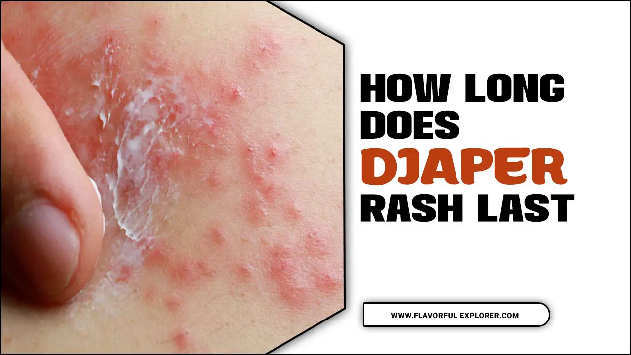 How Long Does Diaper Rash Last
