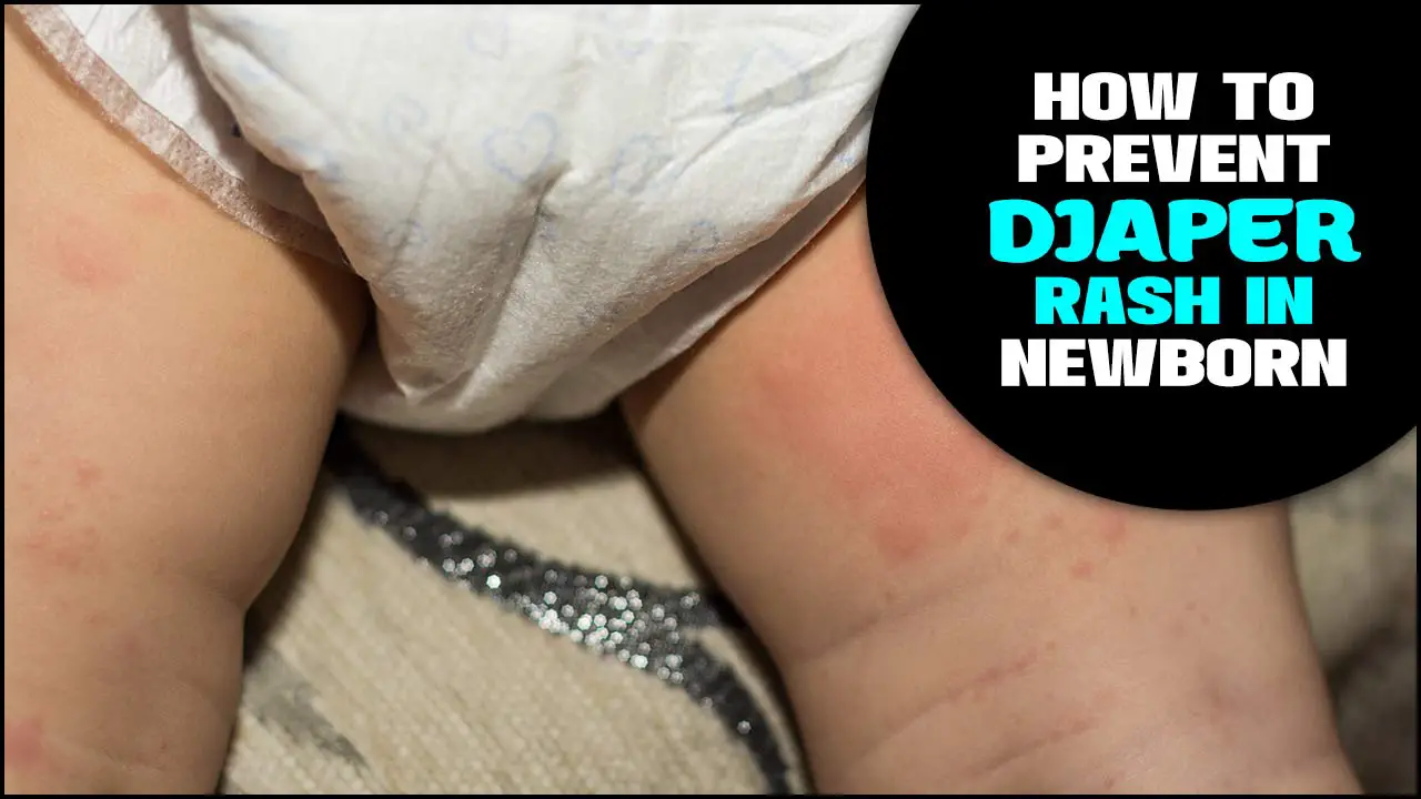 How To Prevent Diaper Rash In Newborn