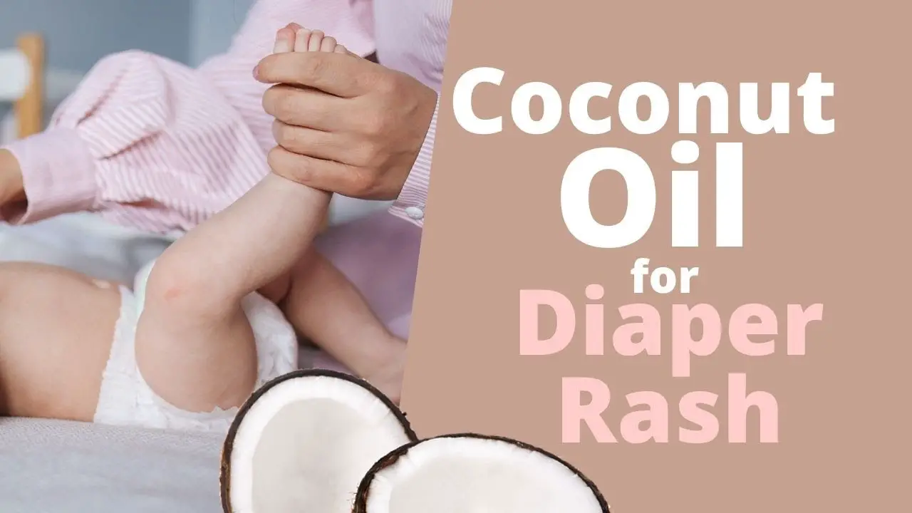 Can I Apply Coconut Oil To My Diaper Rash